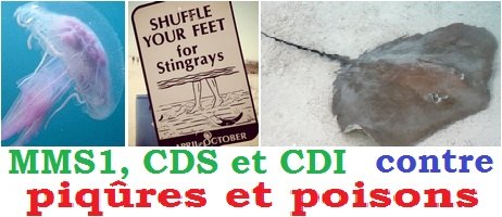 MMS-CDS-CDI-contre-piqures-et-poisons