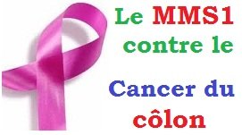 mms1-contre-cancer-du-colon