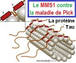 img-Pick-MMS-ProteineTau